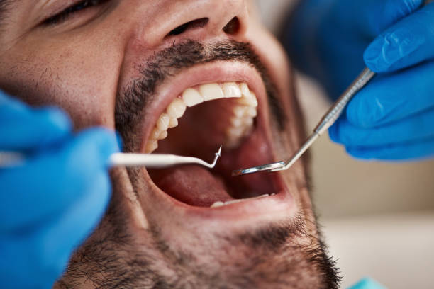Best Knocked-Out Tooth Emergency  in Pleasant Hills, MD